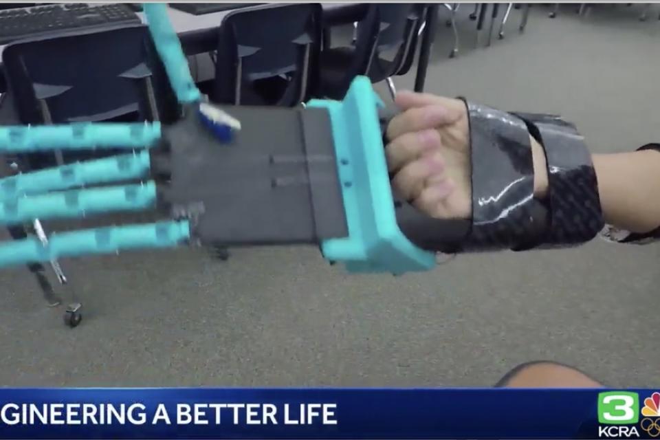 prosthetic arm